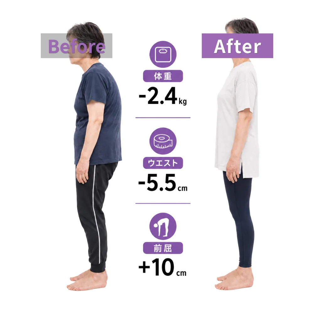 60代女性のお客様のビフォーアフター（モデル）